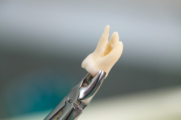 Quick Guide To Wisdom Teeth Extraction